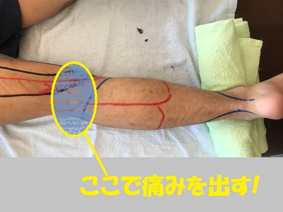 この場所で痛みをだす