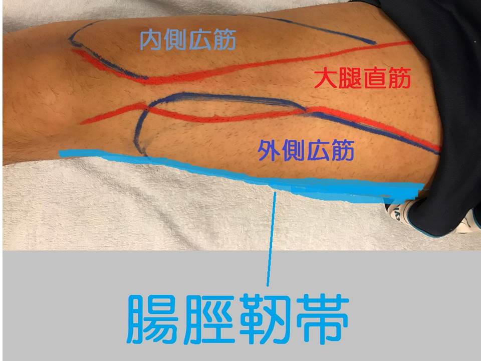 腸脛靭帯