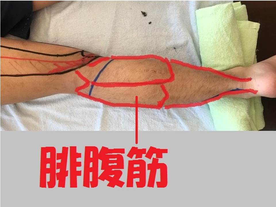 腓腹筋