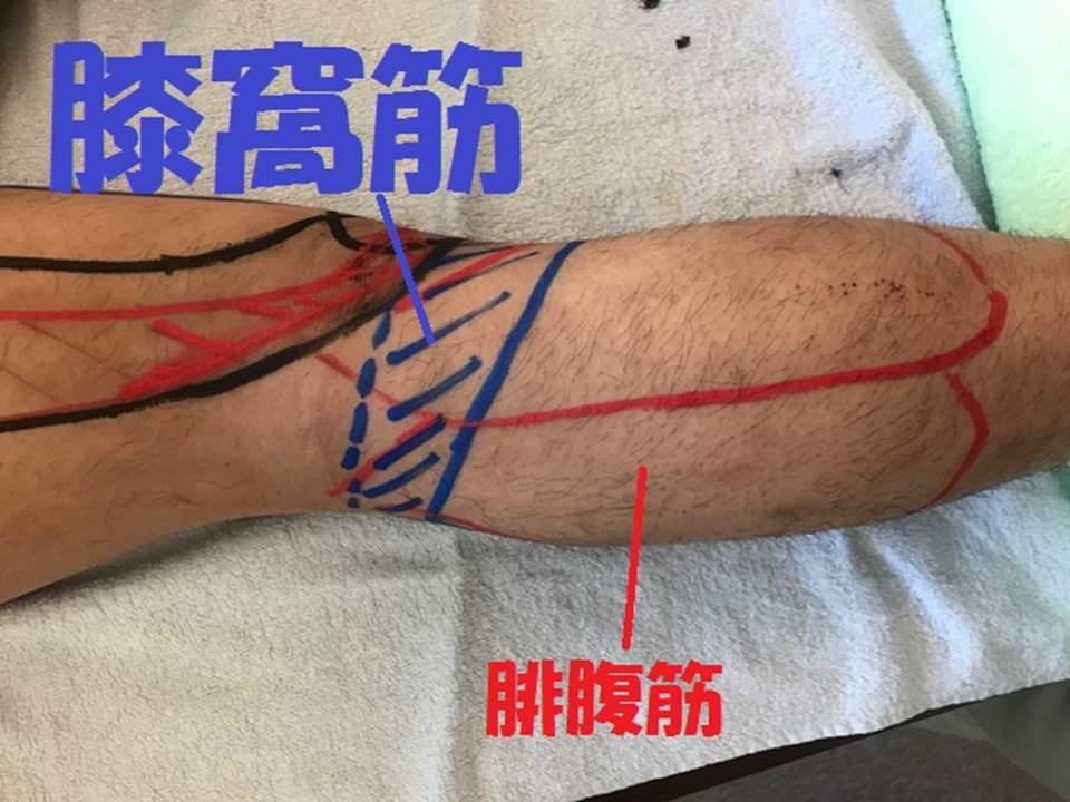 膝窩筋