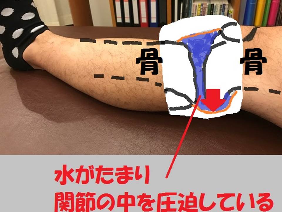 水が貯まる