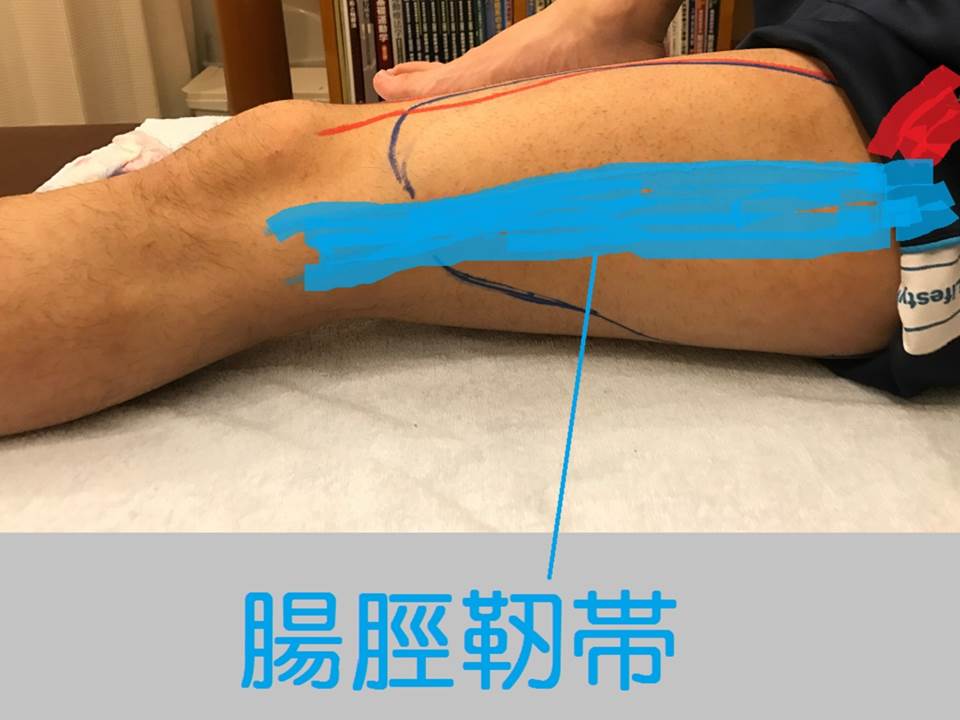 腸脛靭帯