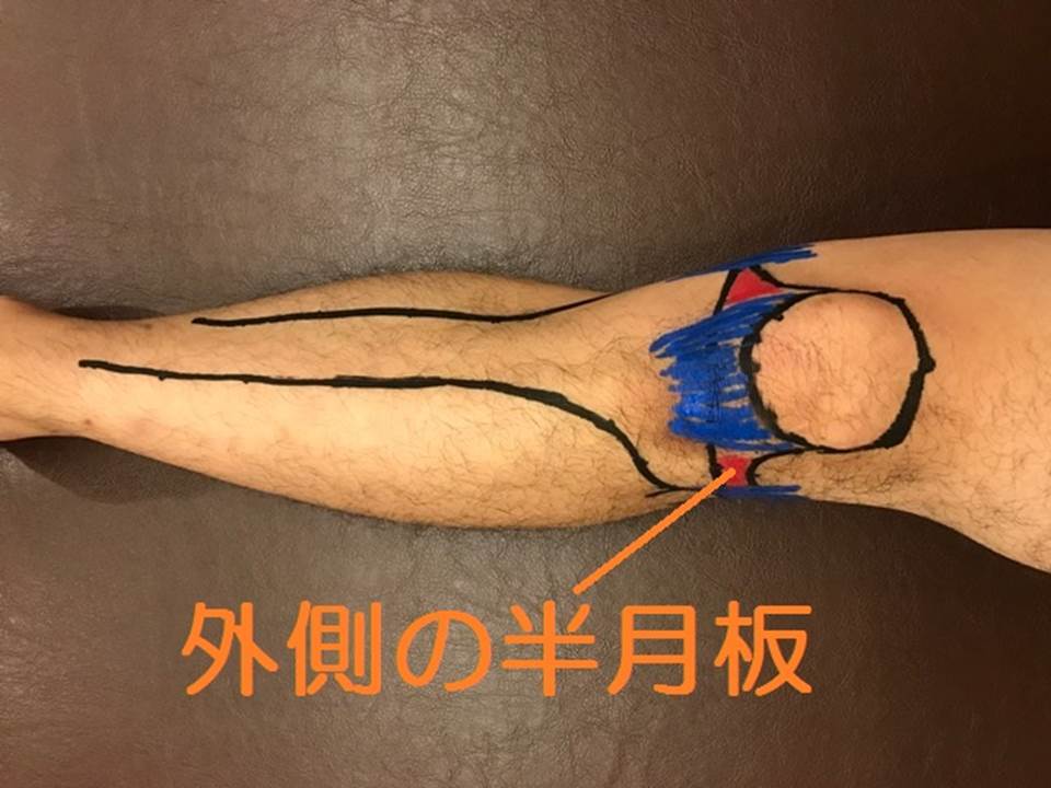外側半月板の場所