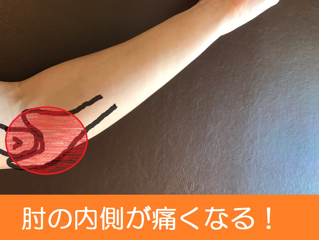 野球肘の重症度チェック 重度な炎症は靭帯や軟骨 骨が損傷しているかも ゼンブログ 長野市の 理学療法士 による整体ブログ