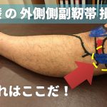 膝の外側が痛い！そんなあなたは膝の『外側靭帯』が損傷しているかも！