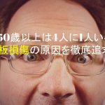 50歳以上は4人に1人いる腱板損傷の原因を徹底追求！