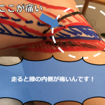 「鵞足炎」かも！？ランニングすると膝の内側が痛みます！