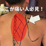 30代に多い！「肩甲骨の内側が痛いんだよね」の原因と改善法