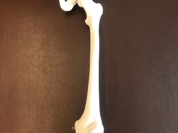 大腿骨模型