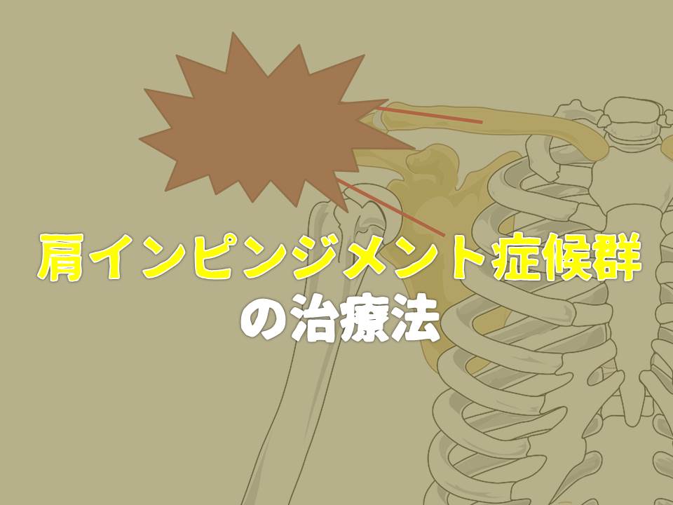 18のセルフケア でインピンジメント症候群を改善 修復時期に応じた対処法がカギだ ゼンブログ 長野市の 理学療法士 による整体ブログ