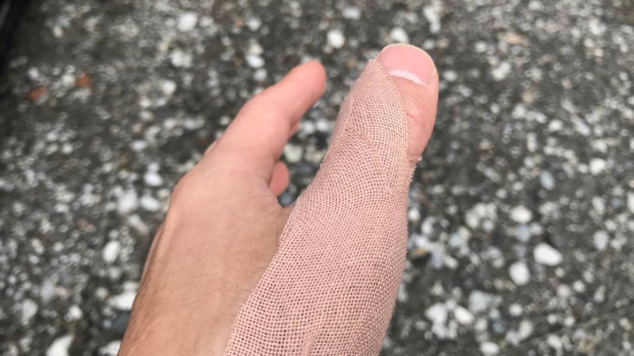 親指の怪我